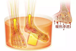 10人9湿 夏天不泡脚,怎么瘦得了 21天告别湿气体质