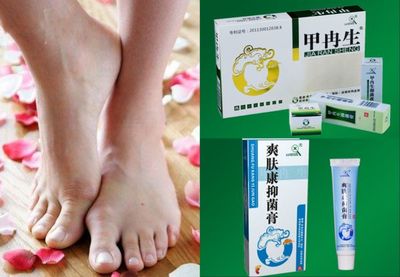 夏季足癣高发,治疗注意这些误区